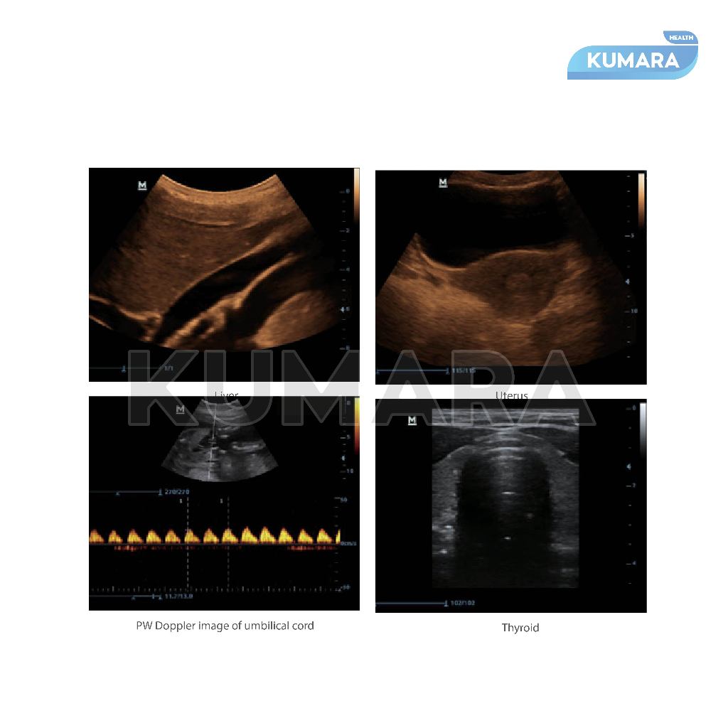 MINDRAY - Mindray USG DP-10 Power PW Doppler | USG 3 MINDRAY - Mindray USG DP-10 Power PW Doppler | USG - Image 3