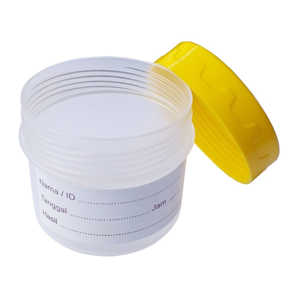 MEDIA - Sample Container / Pot Urine / Pot Dahak Pcs 3 MEDIA - Sample Container / Pot Urine / Pot Dahak Pcs - Image 3