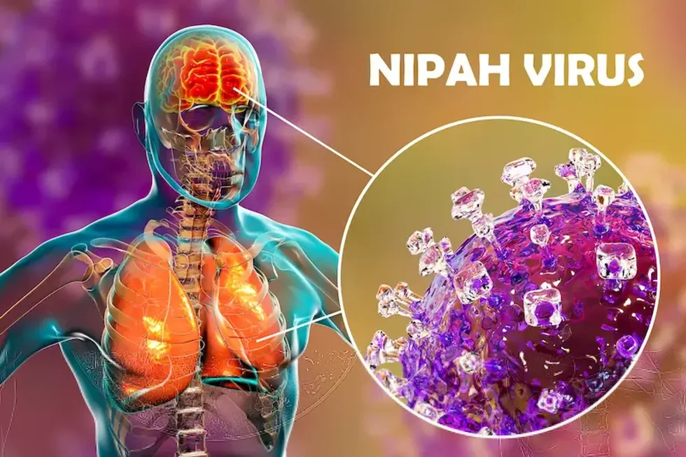 ⚠️ Kenalan Sama Virus Nipah: Virus Langka Tapi Bahaya 3 image 3