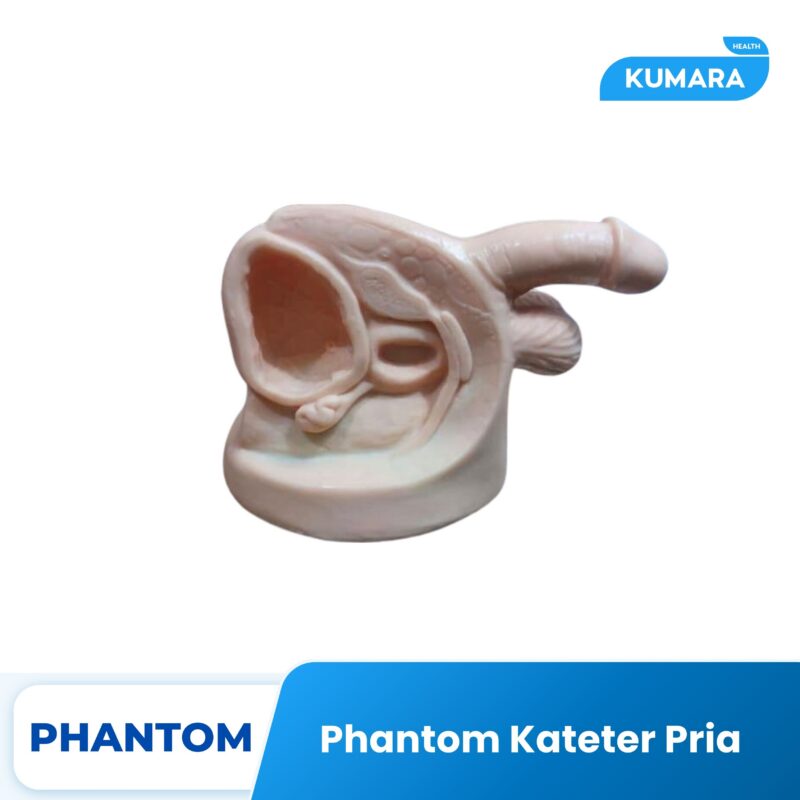 155